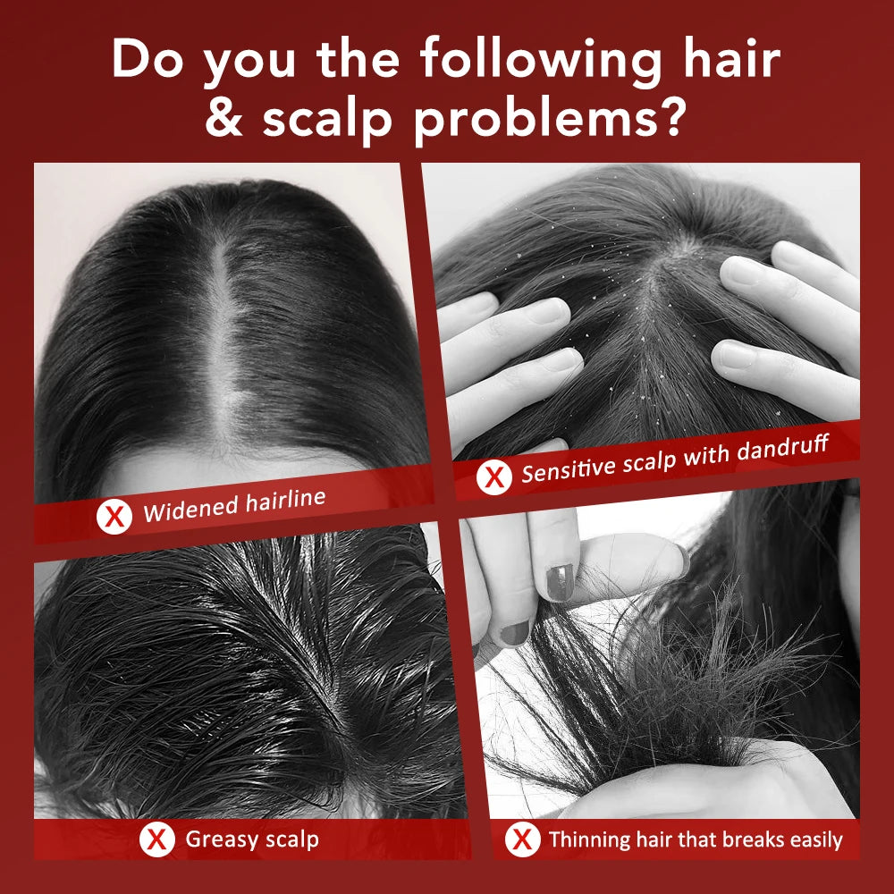 Electric Vibration Massage Comb Red Light Therapy Hair Growth Massage Scalp Brush Anti Hair Loss Liquid Oil Applicator Hair Care